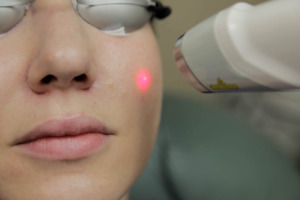 Laser Genesis