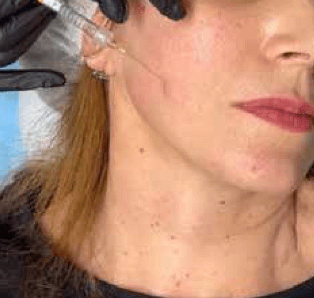 Aplikacija skinboostera